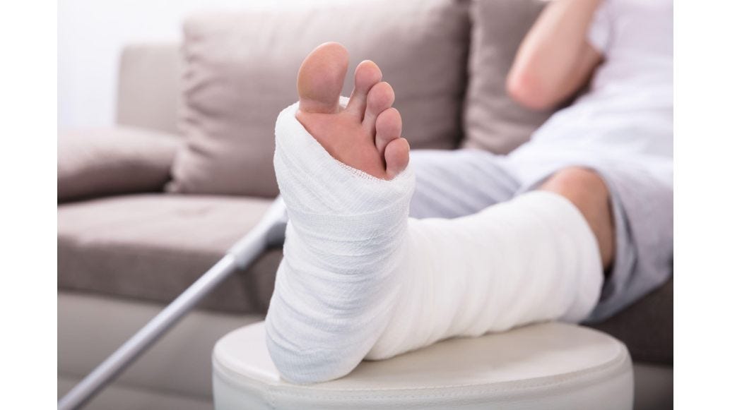 6 Exercises to Try After Leg/Ankle/Knee Cast Removal